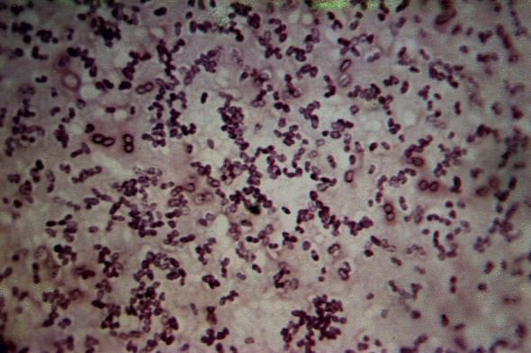 azotobacter vinelandii