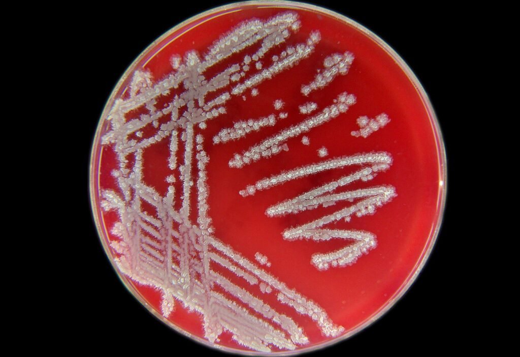 bacillus licheniformis