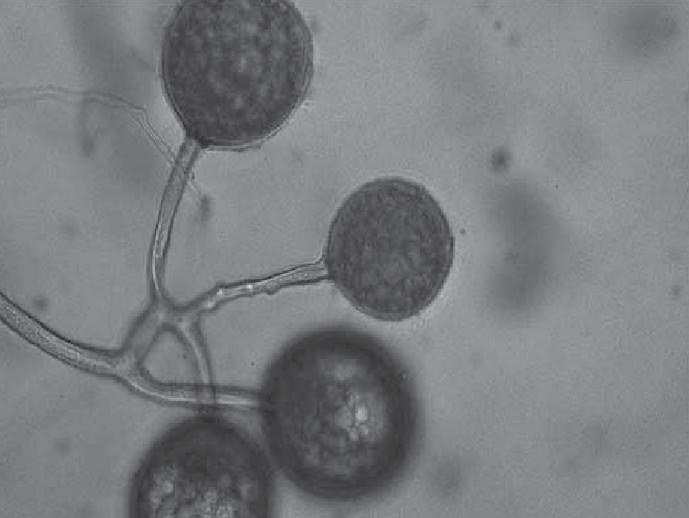 glomus